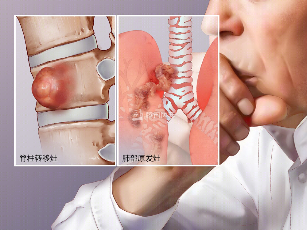 蚂蚁纪录片_蚂蚁纪录片有哪些_蚂蚁纪录片中文版
