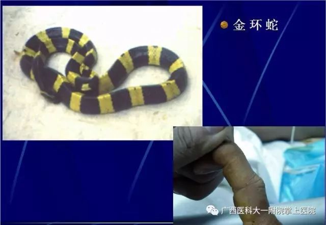 红毒蛇奥伯伦 长城-奥伯伦长城传奇：红毒蛇对决李云，惊心动魄一战