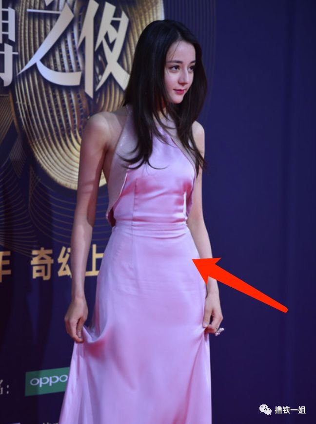 肥胖去掉腿纹上的肉_怎么能去掉肥胖纹腿上_腿上肥胖纹怎么去掉